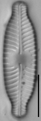 Placoneis paraelginensis LM5