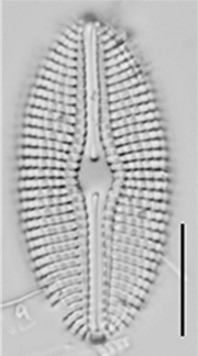 Diploneis calcilacustris LM2