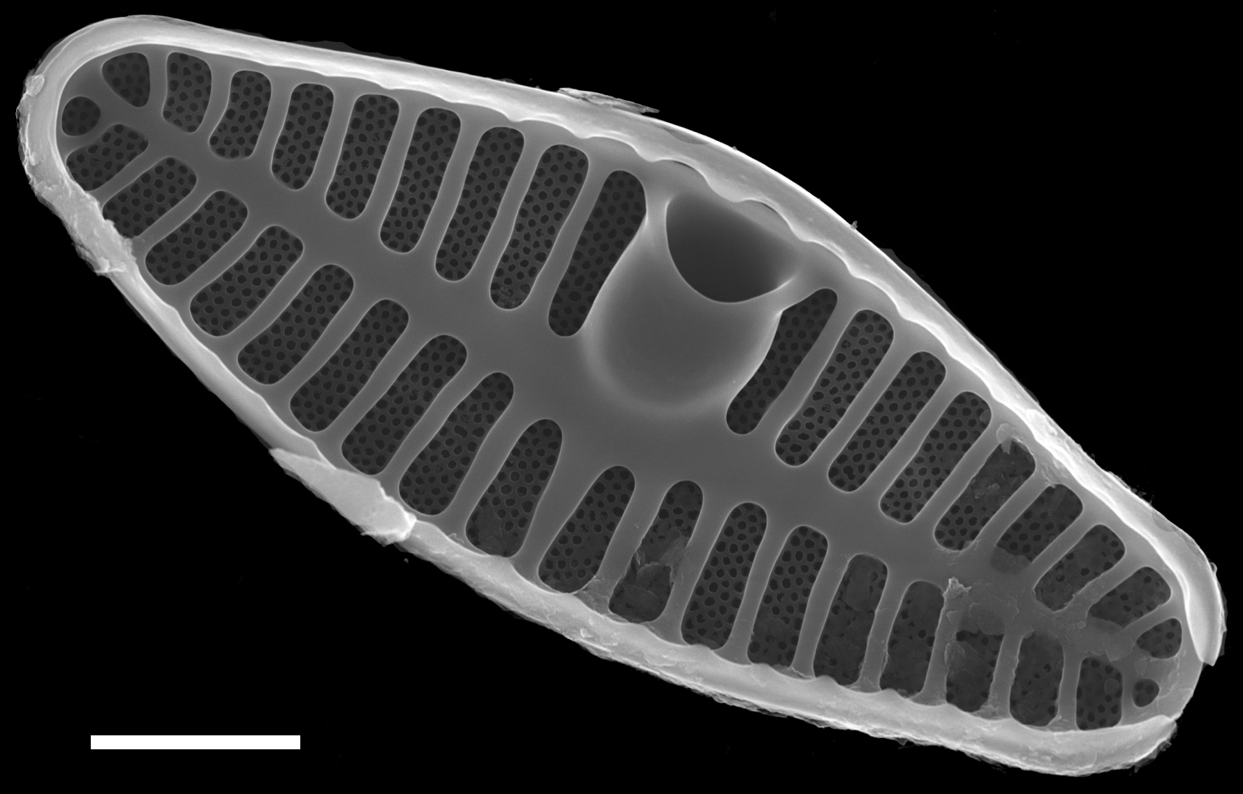 Planothidium frequentissimum SEM1