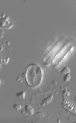 Psammothidium curtissimum LM6