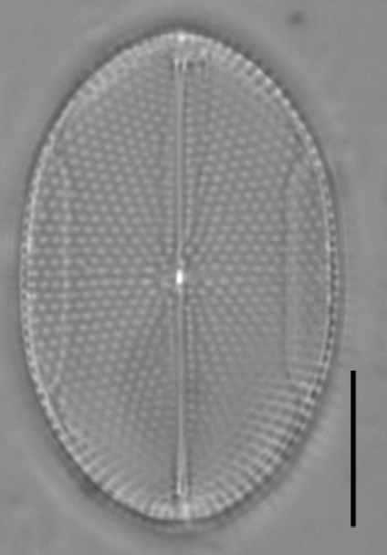 Mastogloia binotata ILL L 14 36 02