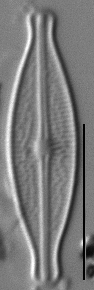 Brachysira microcephala LM3