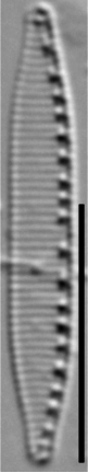 Nitzschia acidoclinata LM11