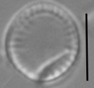 Nanofrustulum cataractarum LM4
