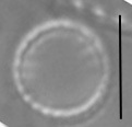 Nanofrustulum cataractarum LM5