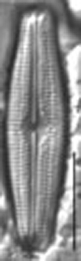 Neidiopsis hamiltonii LM6