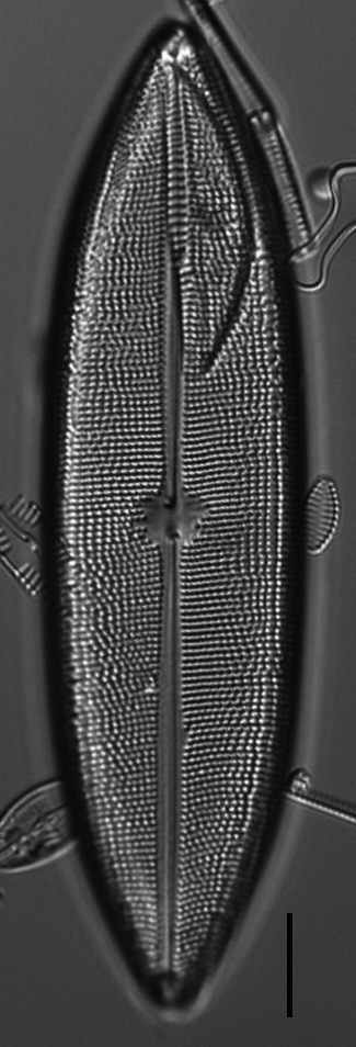 Neidium amphigomphus LM5