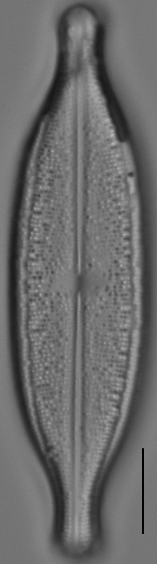 Neidium Productum Lm2