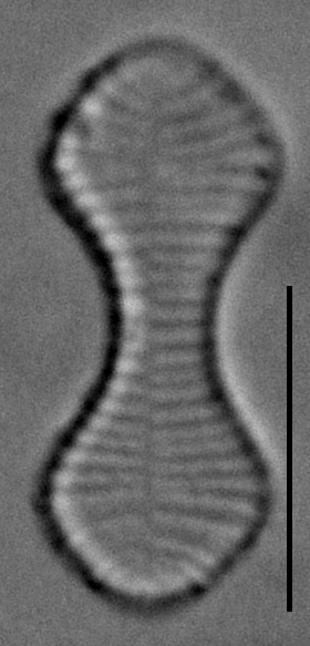 Oxyneis binalis LM6