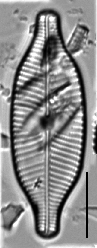 Placoneis explanata LM11