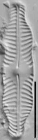 Pinnularia pluvianiformis LM5
