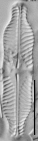 Pinnularia pluvianiformis LM7