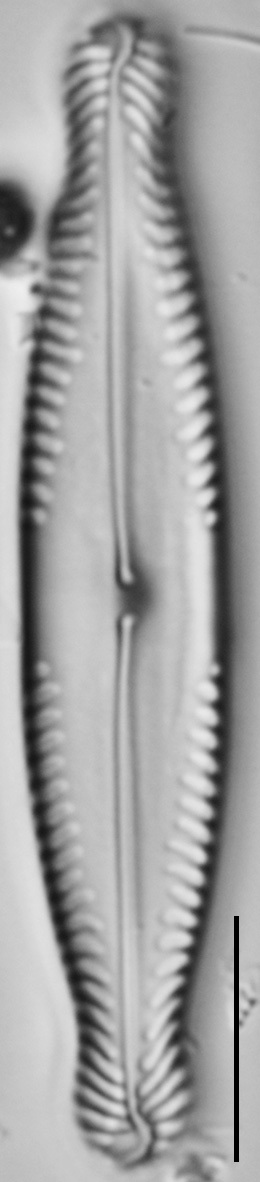 Pinnularia brauniana LM6