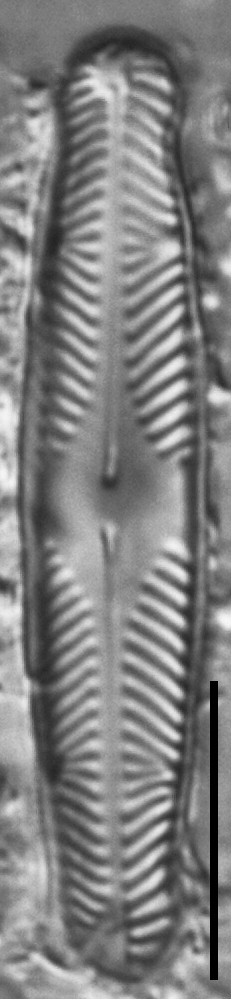 Pinnularia divergentissima subrostrata LM3