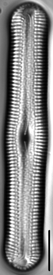 Pinnularia acrosphaeria LM5