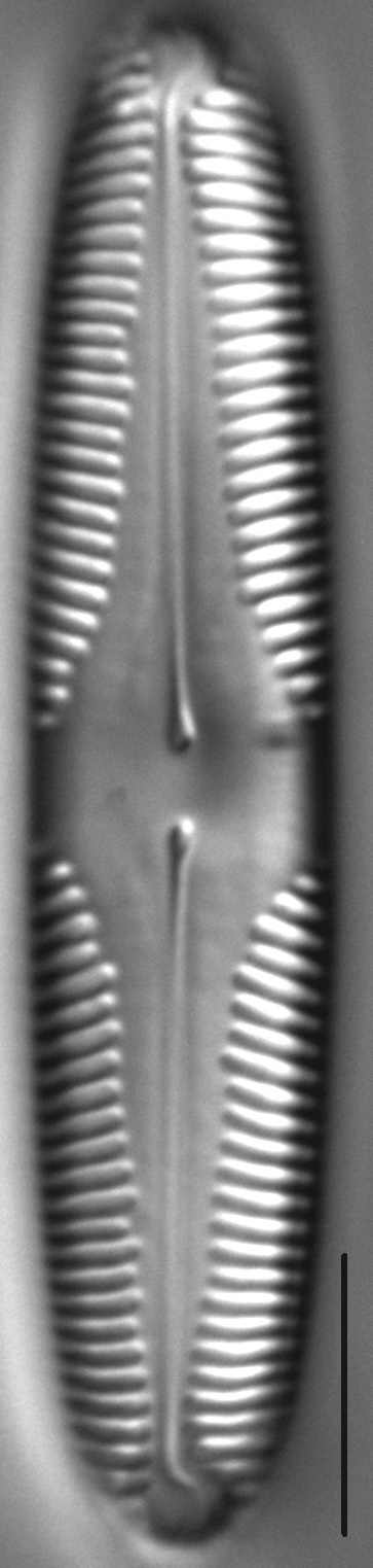 Pinnularia brebissonii LM6