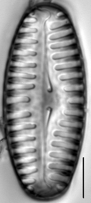 Pinnularia lata LM4