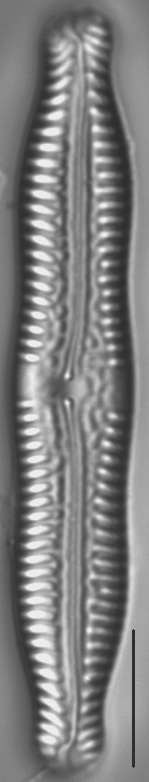 Pinnularia nodosa LM5