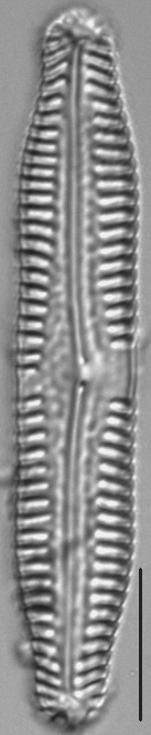 Pinnularia nodosa LM4