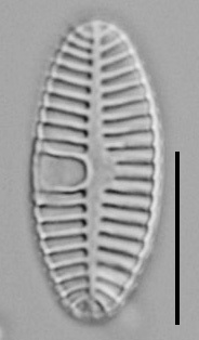 Planothidium Sheathii Lm02