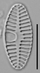 Planothidium Sheathii Lm04