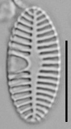 Planothidium Sheathii Lm07