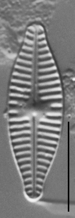 Planothidium Incuriatum Gc110451A 6A