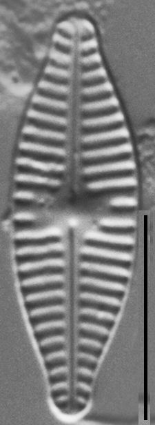 Planothidium Incuriatum Lm6