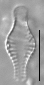 Pseudostaurosira pseudoconstruens LM5