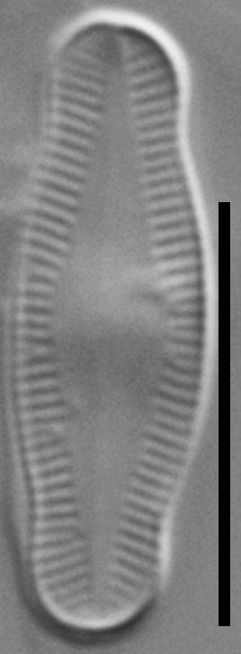 Psammothidium Ventrale GC8166a 23