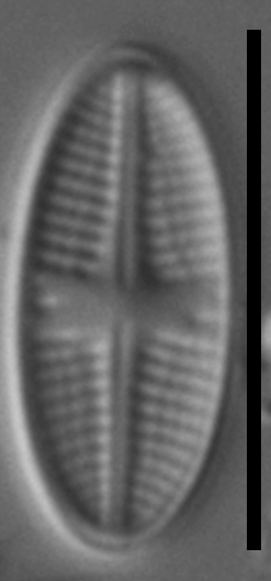 Psammothidium sacculum LM1