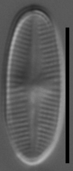 Psammothidium sacculum LM3