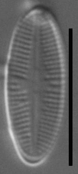 Psammothidium sacculum LM6