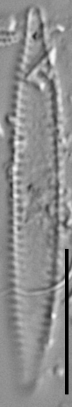 Pseudostaurosira microstriata LM1