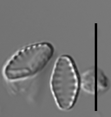 Pseudostaurosiropsis geocollegarum2 ILL L1433