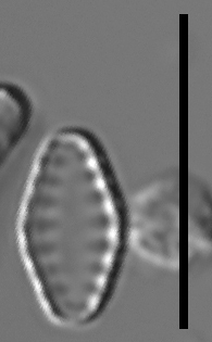 Pseudostaurosiropsis geocollegarum2 ILL L1433