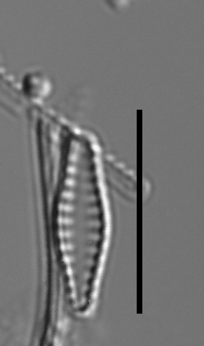 Pseudostaurosiropsis geocollegarum4 ILL L1433