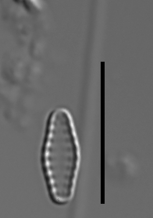 Pseudostaurosiropsis geocollegarum5 ILL L1433