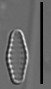 Pseudostaurosiropsis geocollegarum5 ILL L1433