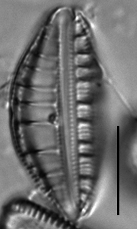 Rhopalodia gibberula LM7