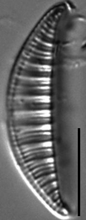 Rhopalodia gibberula LM6