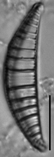 Rhopalodia gibberula LM5