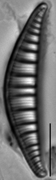 Rhopalodia gibberula LM4