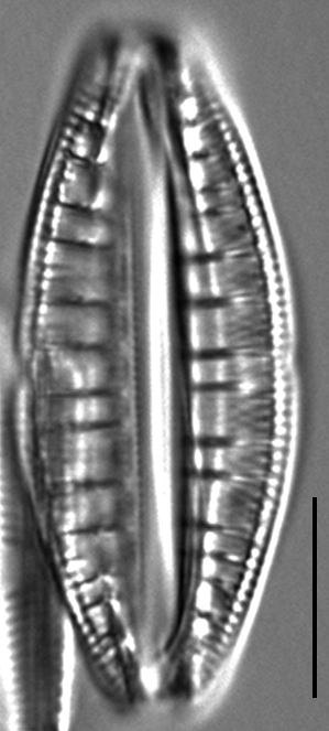 Rhopalodia gibberula LM3