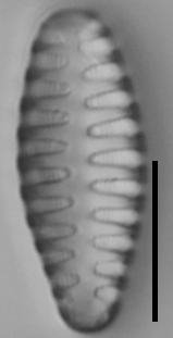 Staurosirella martyi LM15