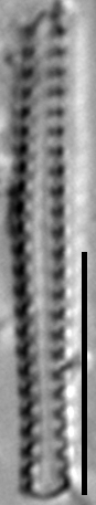 Staurosirella berolinensis LM4