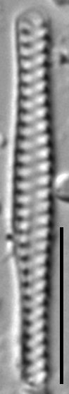 Staurosirella berolinensis LM3
