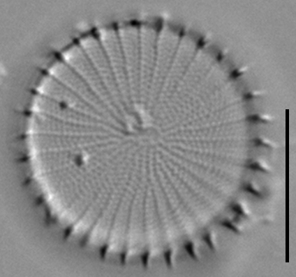 Stephanodiscus hantzschii f tenuis LM5