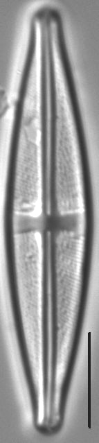 Stauroneis bryocola LM2