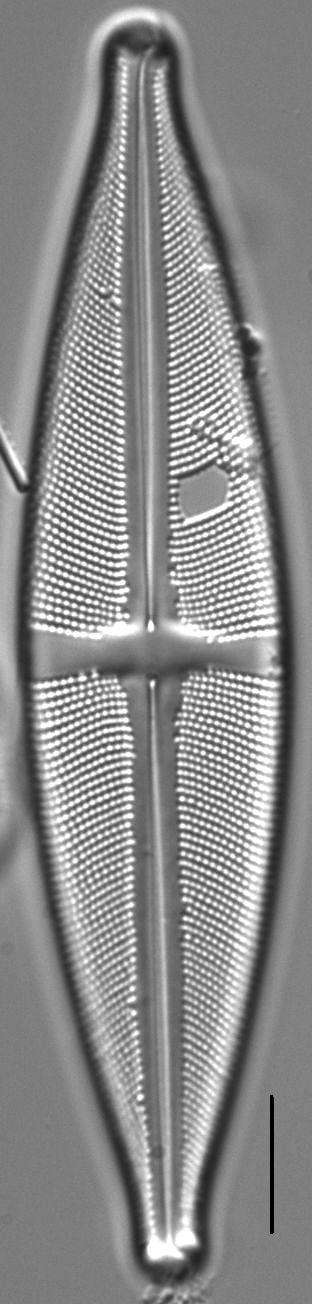 Stauroneis conspicua LM3
